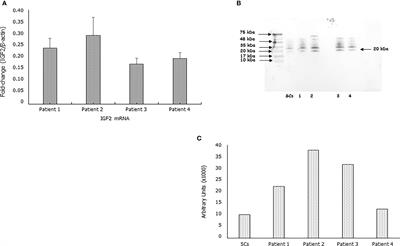 Sperm-carried IGF2 downregulated the expression of mitogens produced by Sertoli cells: A paracrine mechanism for regulating spermatogenesis?